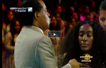 She Was Healed Of Severe Acne Vulgaris