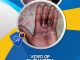 Healed Of Sepsis
