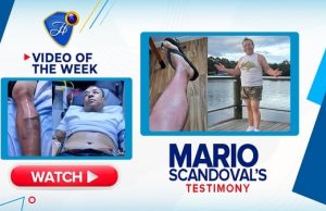 Healed Of Extensive Burns