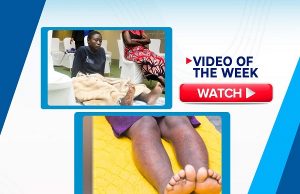 Liberated From The Scars And Pains Of Skin Cancer