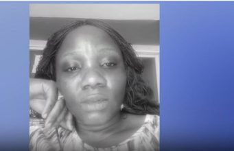 A Miraculous Transformation As Helen’s Wound Dries Up